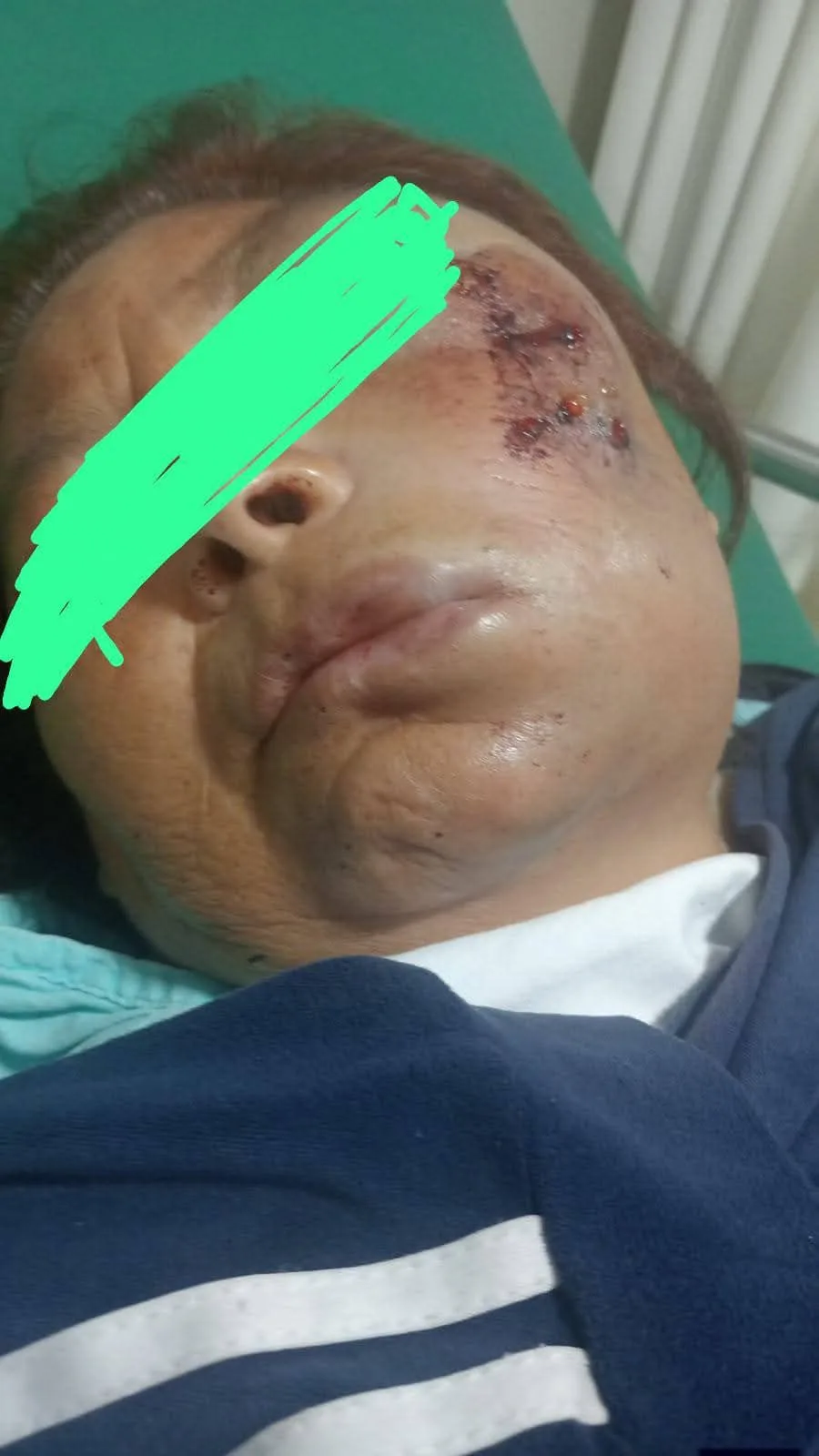 Golpeó a su pareja, la aventó por las escaleras y finalmente la abandonó; en clínica del IMSS, de SJR.